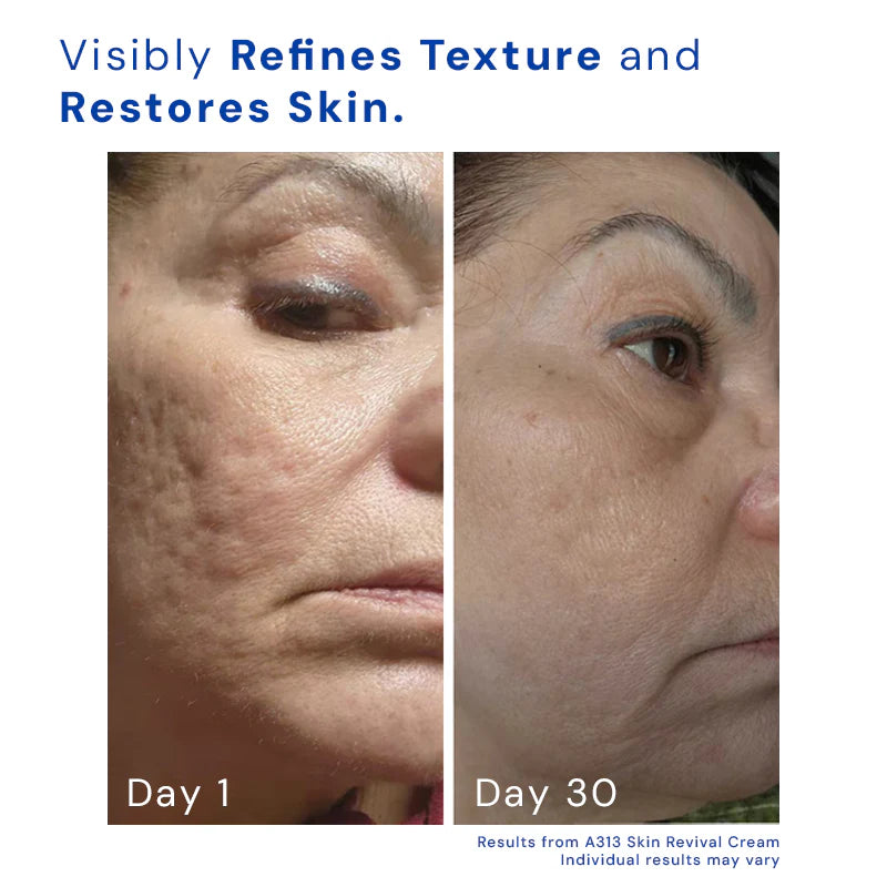Elixir™ Opulence Retinol
