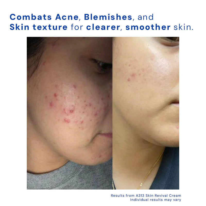 Elixir™ Opulence Retinol