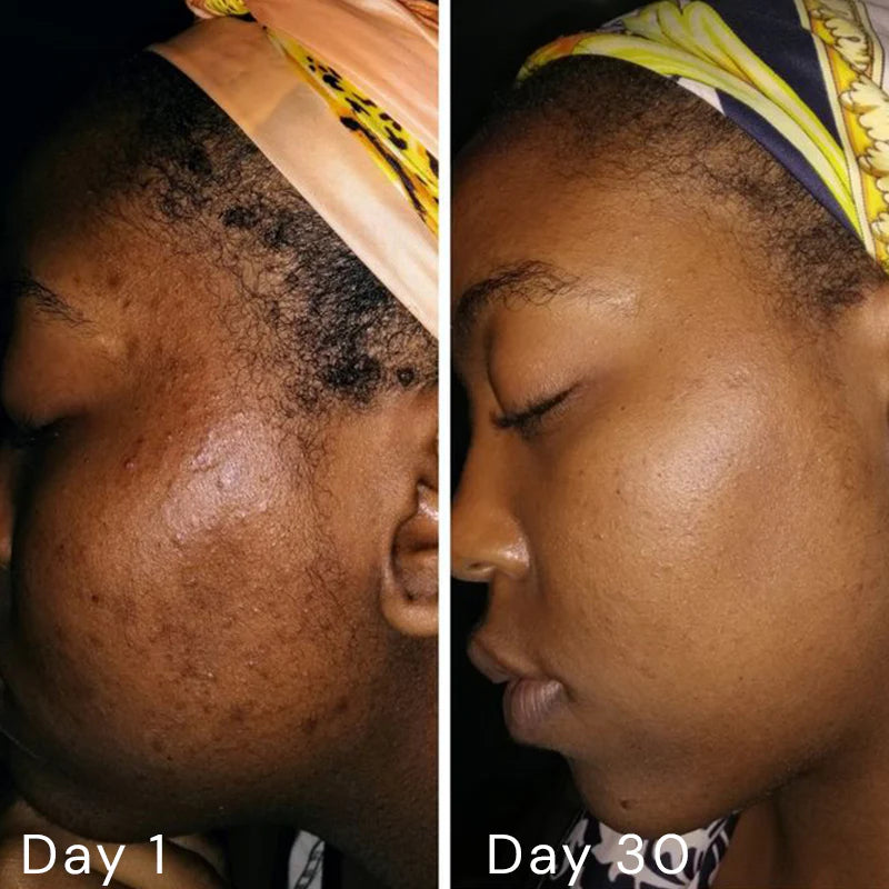 Elixir™ Opulence Retinol