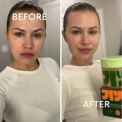 Elixir™ Anti-Aging Pads