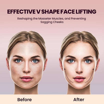 Elixir™V-Sculpt EMS 3.0
